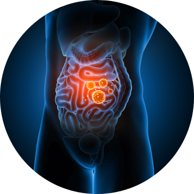 Pathologies digestives, chroniques et inflammatoires, lien avec les produits animaux et notamment les produits laitiers 