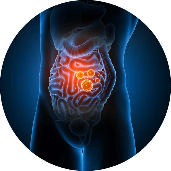 Pathologie chronique inflammatoire digestive allergies maladies auto immunes hyperméabilité intestinale immunité